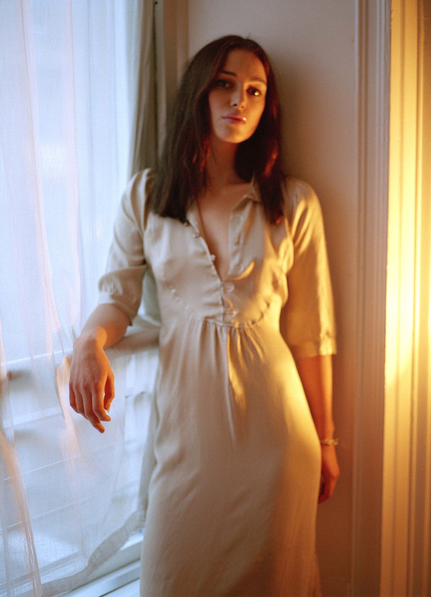 Keira Knightley Leg Photoshoot