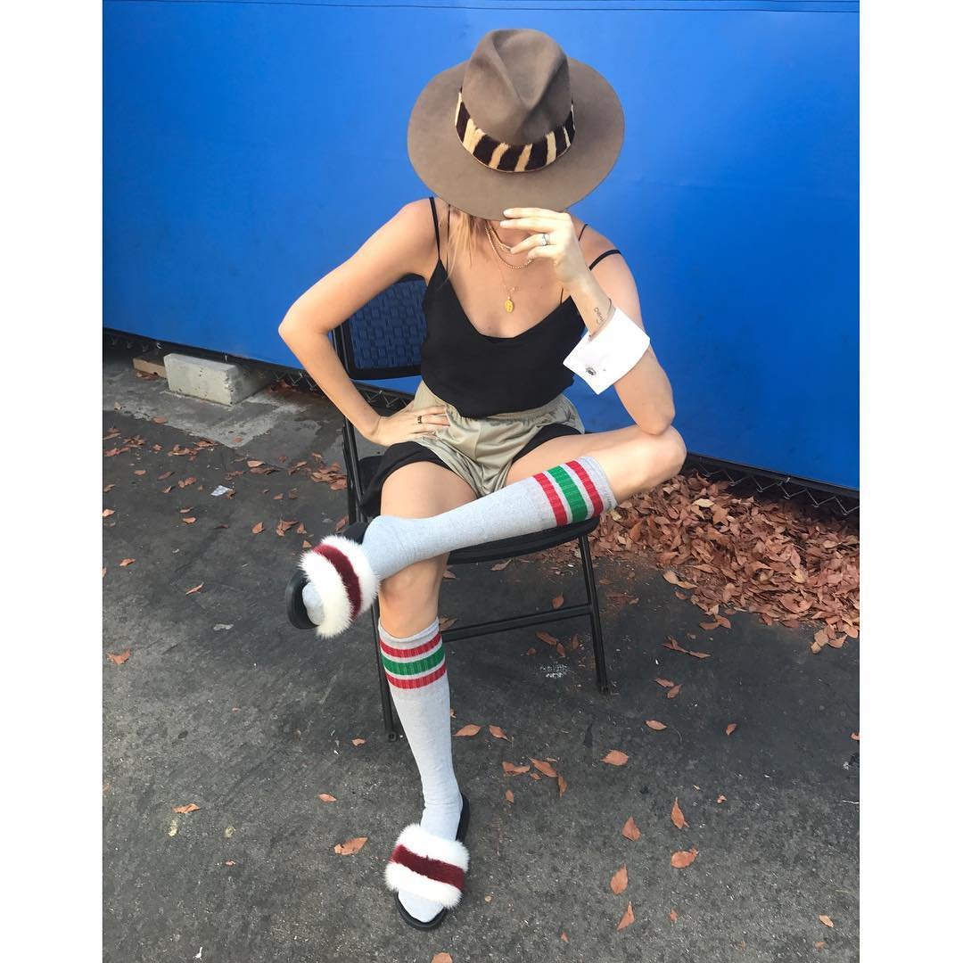 Behati Prinsloo Leg Photoshoot