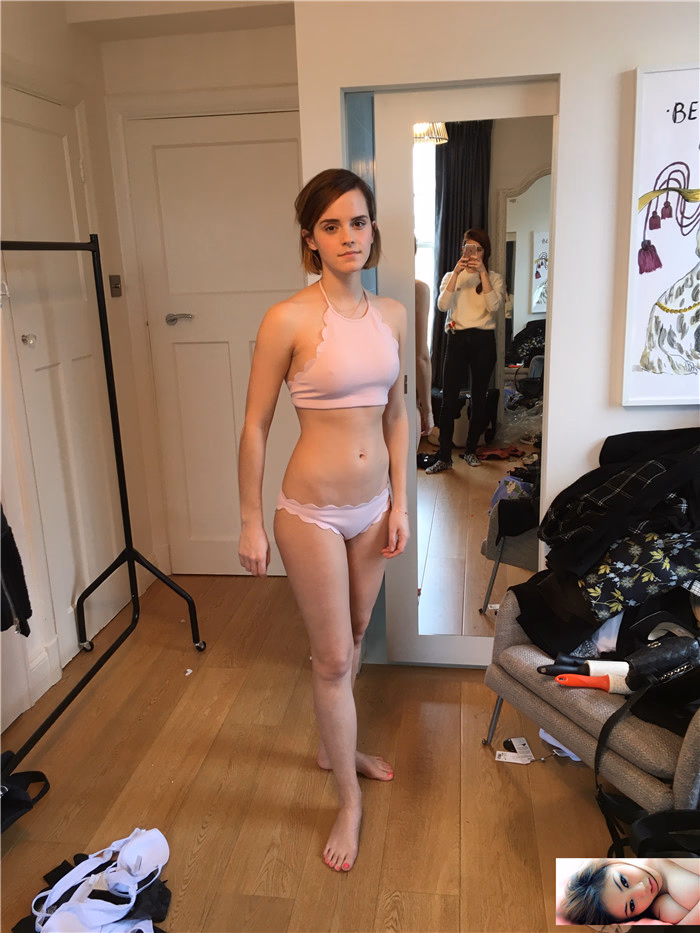 Emma Watson Leg Photoshoot